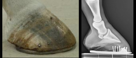Negative Plantar Angle Images