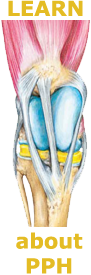Learn About PPH