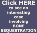 See Interesting Case