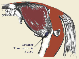 Greater Trochanteric Bursa
