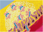 Learn MORE about the PHYSIOLOGY of ARTHRITIS