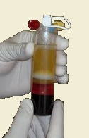 PRP